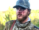 Florida Turkey Hunter Mauled by Panther