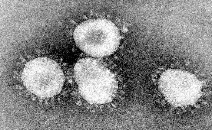Common Sense Ways to Prepare for the Coronavirus Outbreak in the USA